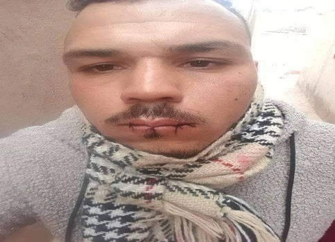 jrada